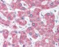 KIAA0152 / MLEC Antibody (N-Terminus)